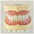 BF Tipo Screw Teeth Dental Study Model 13005, Terno de dentes de substituição para Frasaco Jaw